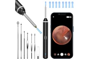 Ear Wax Removal, 1920P FHD Wireless Otoscope Earwax Removal Tool, WiFi Ear Endoscope with LED Lights, Mini Visual Ear Inspect