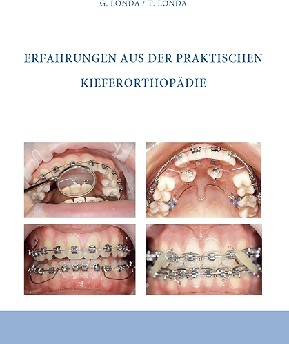 Download Erfahrungen aus der praktischen Kieferorthopädie (German Edition) PDF
