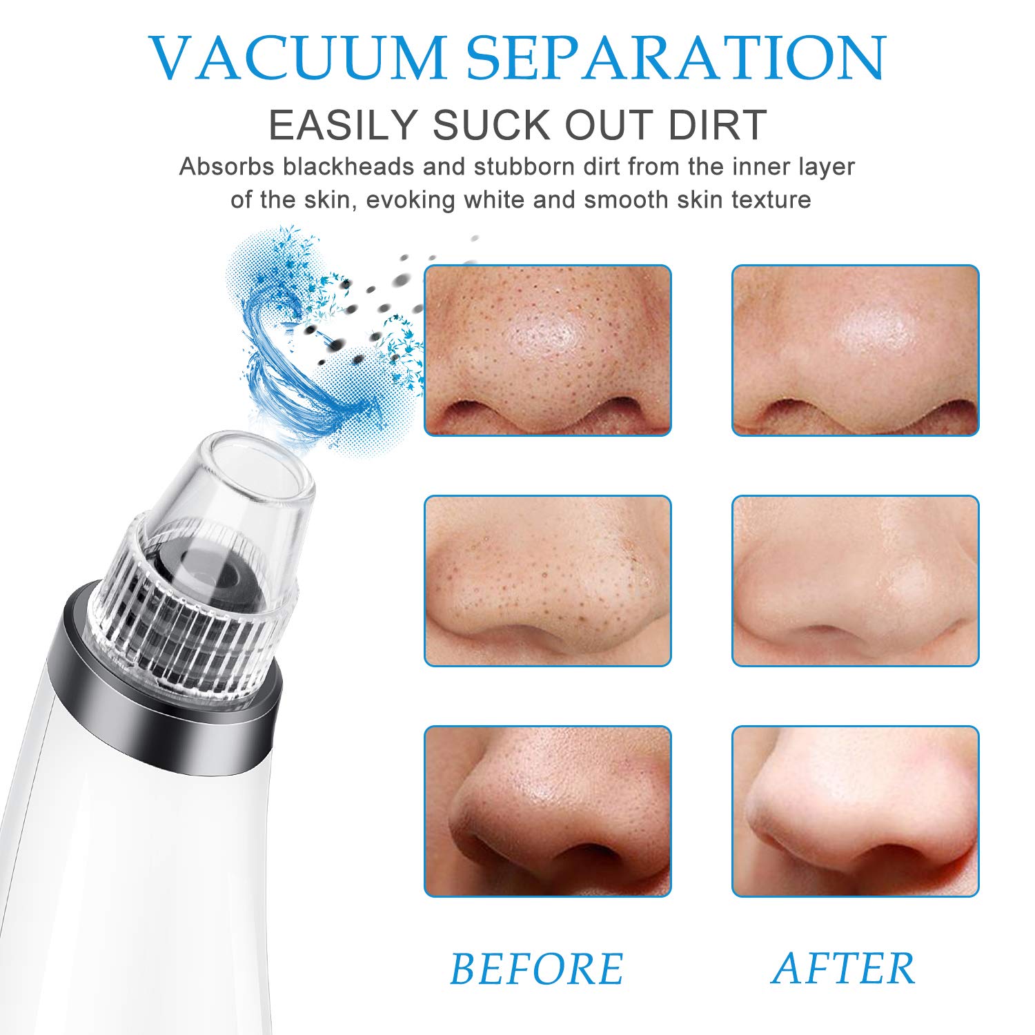 Blackhead Remover Pore Vacuum - JEXCULL Electric Blackhead Removal Tool Acne Extractor Facial Cleaner Suction Tools Kit for Women Men USB Rechargeable LED Display with 5 Suction Probes(Silvery white): Beauty