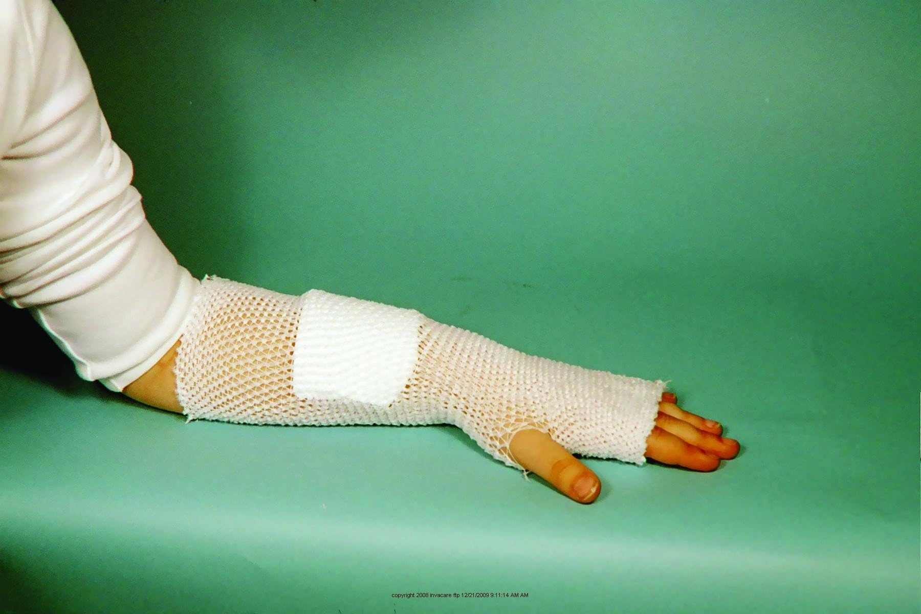 MT SpandageTubular Elastic Dressing Retainer-Size: 4: Medium: arm, Leg, Foot/Large: Hand - UOM = Each 1