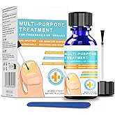 Toenail Fungus Treatment Extra Strength – Nail Repair Liquid with 1% Tolnaftate for Thick, Discolored Toe Nails Fungus Treatments with Precision Brush – 1 fl oz(30 ml)