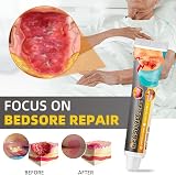 ChengJin Bed Sore Cream - Pressure Sore Relief & Cold Sore Treatment view 6
