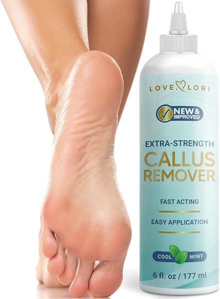 Love Lori Foot Callus Remover Gel Extra Strength Pedicure Tool for Feet 6oz | Quickly, easily, softens and removes dead, hard