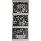Prank 2D Customized Fake Ultrasound Strip of 3 Photos
