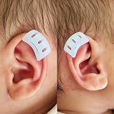 shenzkeji Infant Lop Ear Deformity Correction Clip For Newborn Baby, Fixing Auricle Valgus Patch Stickers Children Ear Shape Aesthetic Corrector Without Surgery