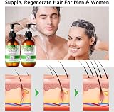 OEWWEX Rosemary Shampoo 300ml Conditioner 10.56oz Hair Care Set Dry to Oily view 7