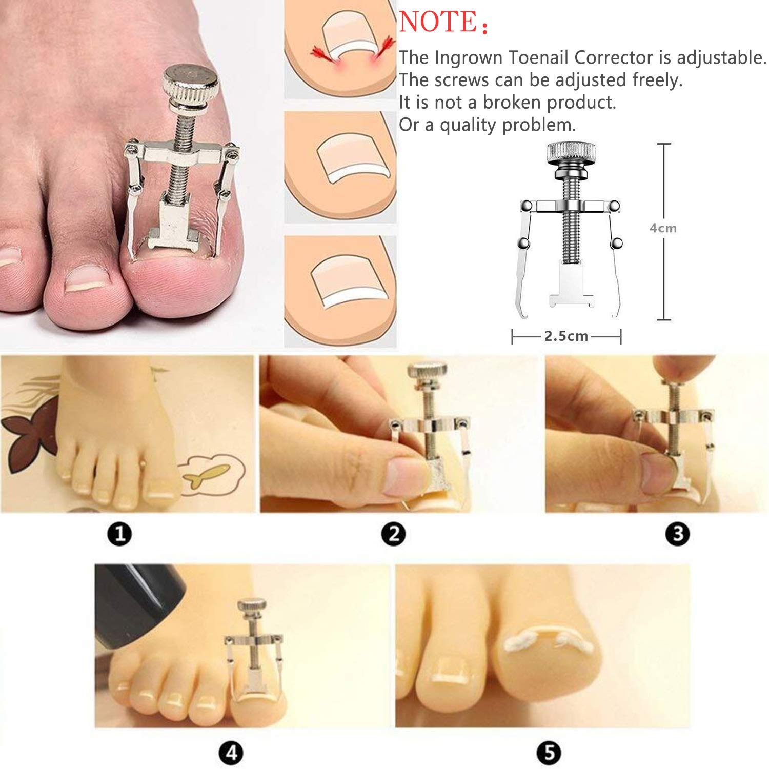 12PCS Ingrown Toenail Tool Ingrown Toenail Treatment Pedicure Tools，Ingrown Toenail Tool Kit Nail Clipper Set Pedicure Kit Ingrown Toenail Pedicure Tool By JTIEO…: Beauty