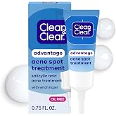 Clean and Clear Advantage Acne Spot Treatment, 0.75 fl oz | 2% Salicylic Acid &amp; Witch Hazel, Acne Pimple Medication, Blemish &amp; Blackhead Removal, Fragrance Free