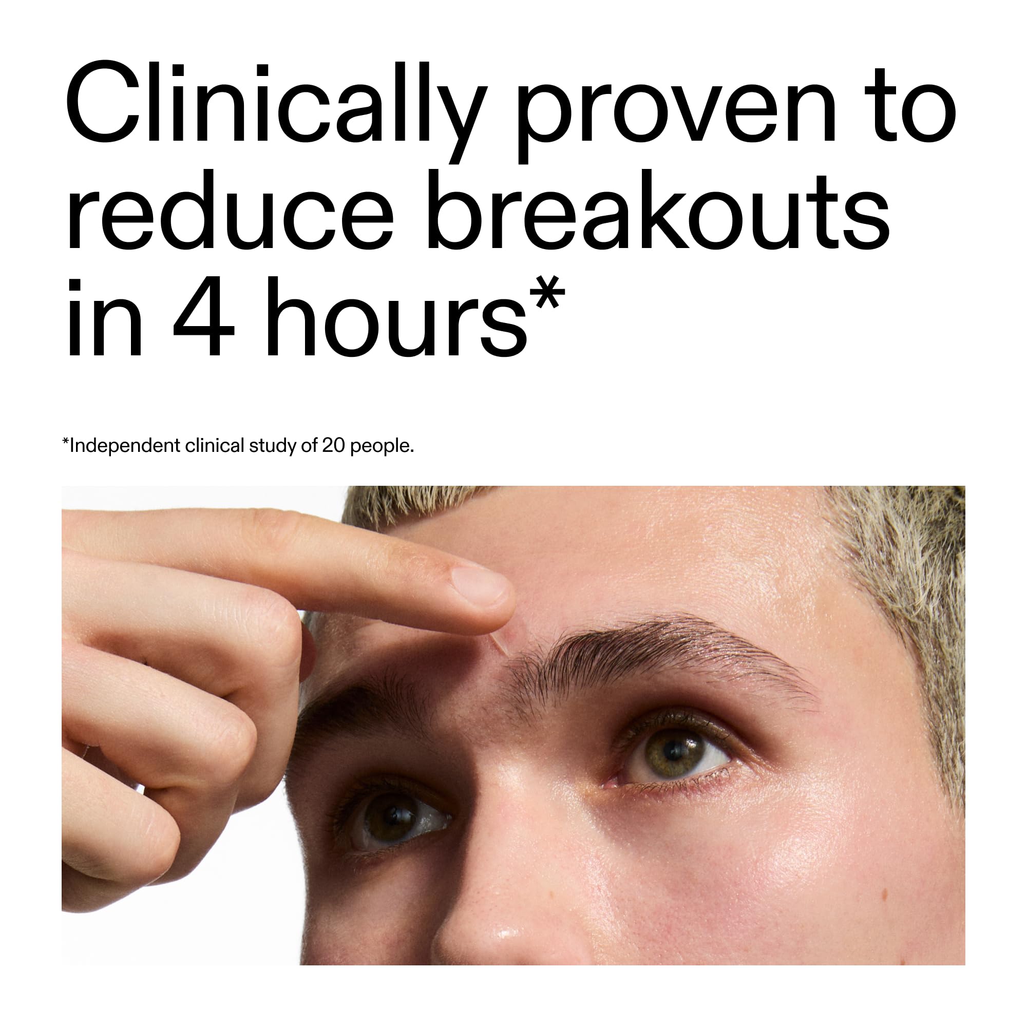 The INKEY List Hydrocolloid Invisible Pimple Patches, Spot Patches Contains Salicylic Acid, Day/Night Anti Acne Patches, Vegan & Cruelty Free, Suitable For All Skin Types