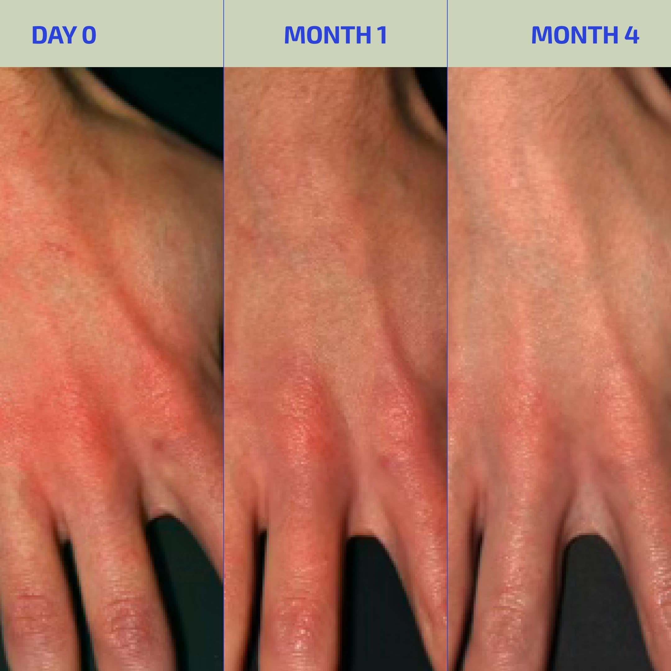 Codex Labs BIA Eczema Relief Lotion, 3.4 oz - Clinically Proven Colloidal Oatmeal 1% for Itchy Dry Eczema Prone Skin - Fragrance Free Moisturizer with BiaComplex 2.0 - Safe for Babies, Kids & Adults