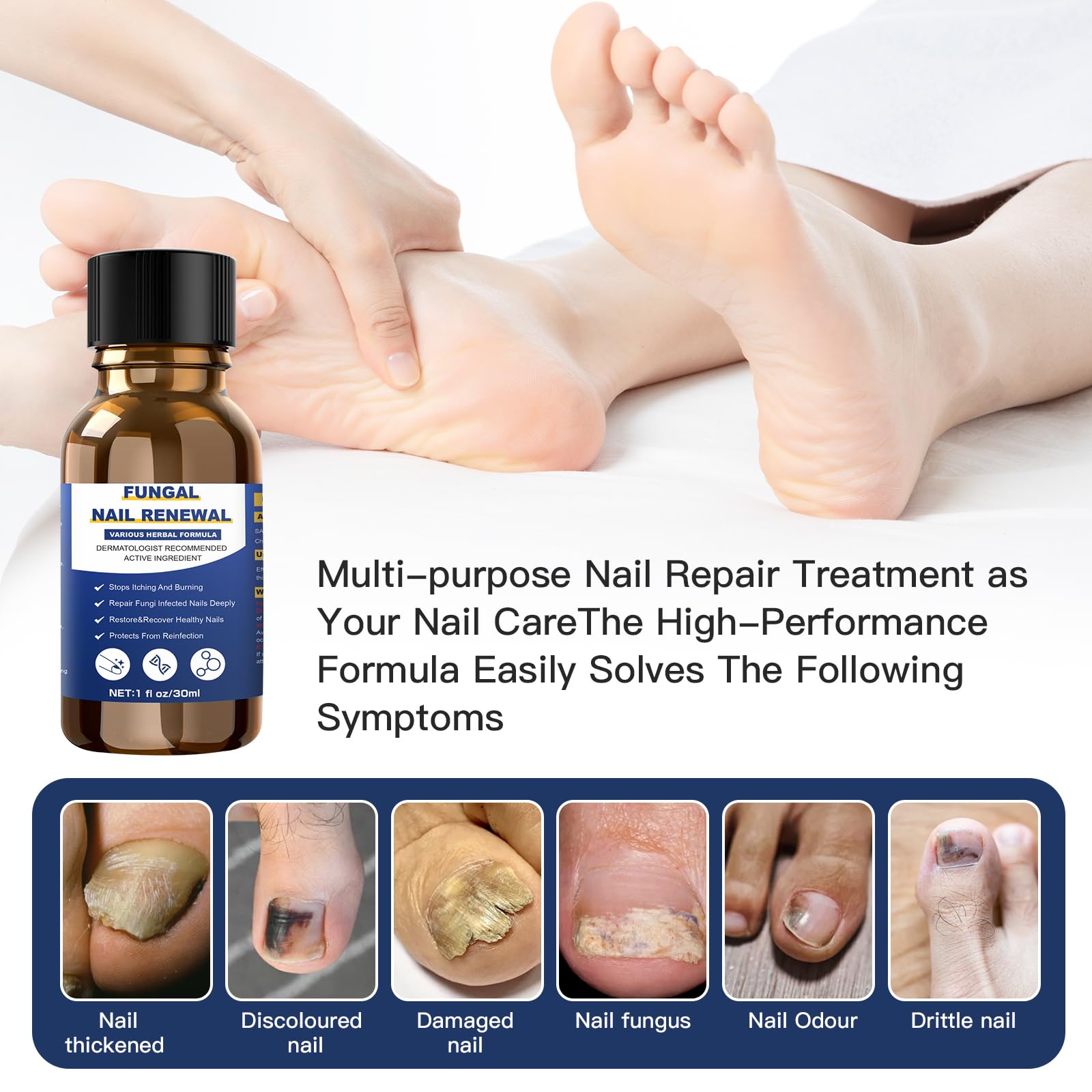 Toenail Fungus Treatment Extra Strength,Nail Fungus Treatment For Toenail,Athletes Foot Treatment,Ingrown Toenail Treatment,Toe Nail Fungus Treatments For Fungi Nail(1fl oz/30ml) - Image 4