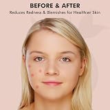 FADII Pimple Patches 200 Dots Star Hydrocolloid Acne Patches view 6
