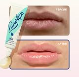 Lanolips 101 Ointment Minty Multipurpose Balm 10g Fragrance Free view 5