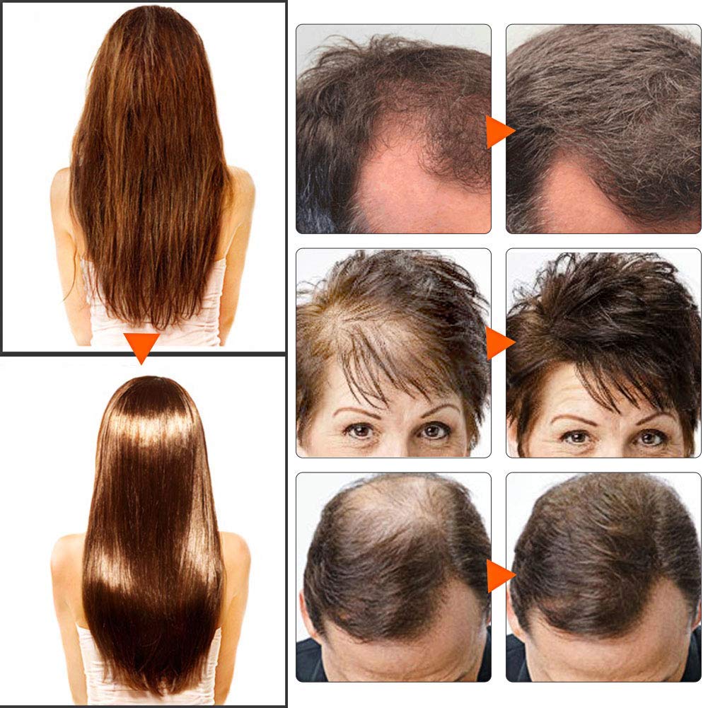 Hair Thickening Shampoo, Hair Growth Shampoo, Hair Loss Shampoo, Hair Loss Treatment, Hair Thinning Shampoo, Natural & Organic Herb Shampoo for Hair Regrowth Faster/Prevent Thinning Hair Loss: Beauty