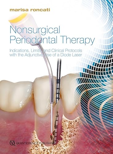 Download Nonsurgical Periodontal Therapy: Indications, Limits, and Clinical Protocols With the Adjunctive Use of a Diode Laser PDF