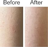 The INKEY List Glycolic Acid Exfoliating Body Stick 45g Fragrance Free view 7