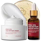 Salmon DNA PDRN & EGF Peptide Duo Set – 25% Concentrate Serum + 12% Cream | Volufiline + Salmon DNA + Phyto PDRN | Post-Microneedling Anti-Aging w/Niacinamide & Hyaluronic Acid | Korean Skincare