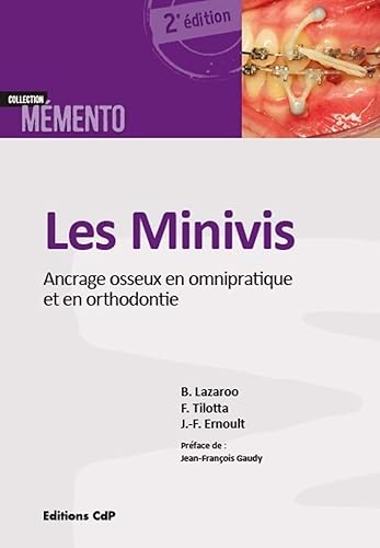 Download Les minivis: Ancrage osseux en omnipratique et en orthodontie. PDF