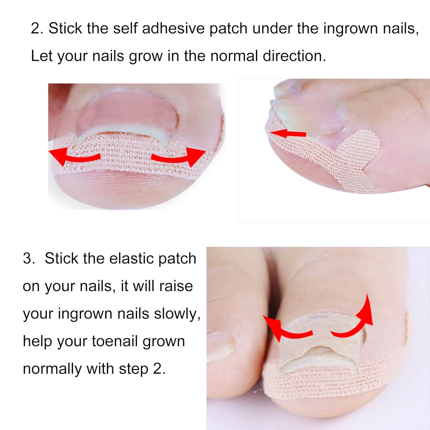 Ingrown Toenail Tools With Corrector Stickers, 30 Pcs Toe Nail Lifter Treatment Patch for Pedicure, Fix Curved Toenail Tape Recover Correction for Paronychia (Gold): Beauty