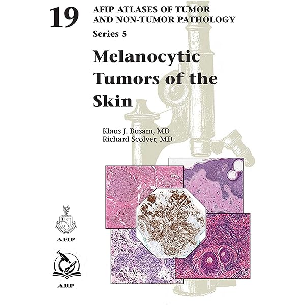 Non-Neoplastic Disorders of the Lower Respiratory Tract (Atlas of Non-Tumor Pathology， Series 1，) [ハードカバー] Travis， William D.， M.D.; Armed Forces Institute of Pathology 51rpKU5JhaL.jpg_BO30,255,255,