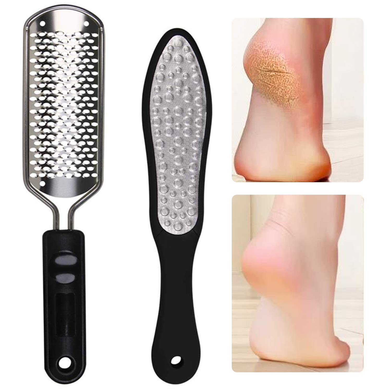 Oneleaf 2PCS Professional Pedicure Rasp Foot File Cracked Skin Corns Callus Remover for Extra Smooth and Beauty Foot : Beauty