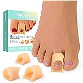 Welnove Hammertoe Corrector - 6 Pack Toe Splints - Soft Gel Toe Straighteners - Realign Bent, Curled, Crooked, Claw, Hammer Toes - Toe Corrector for Men and Women, 3 Different Sizes (Beige)