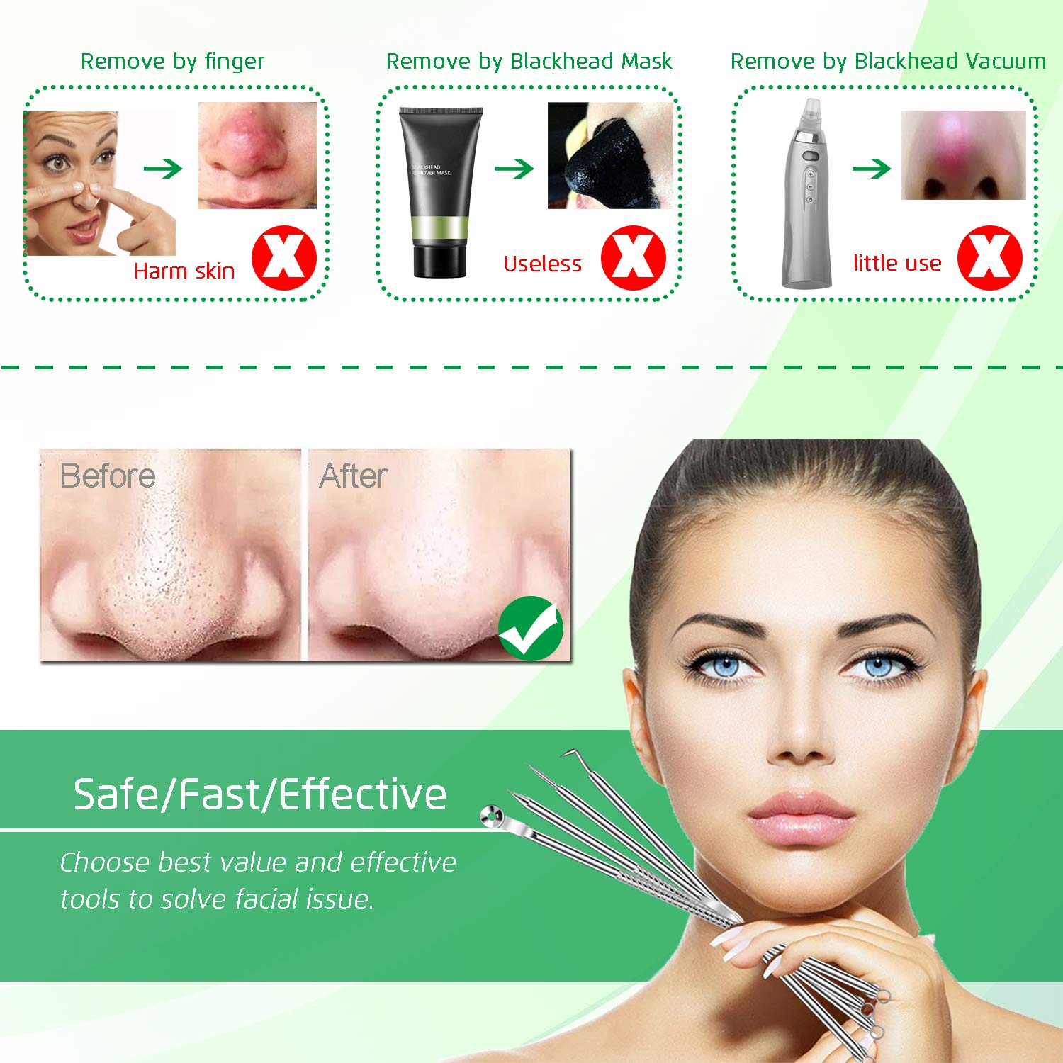 5PCS Blackhead Remover Comedone Extractor, Curved Blackhead Tweezers Kit, Professional Stainless Pimple Acne Blemish Removal Tools Kit: Beauty