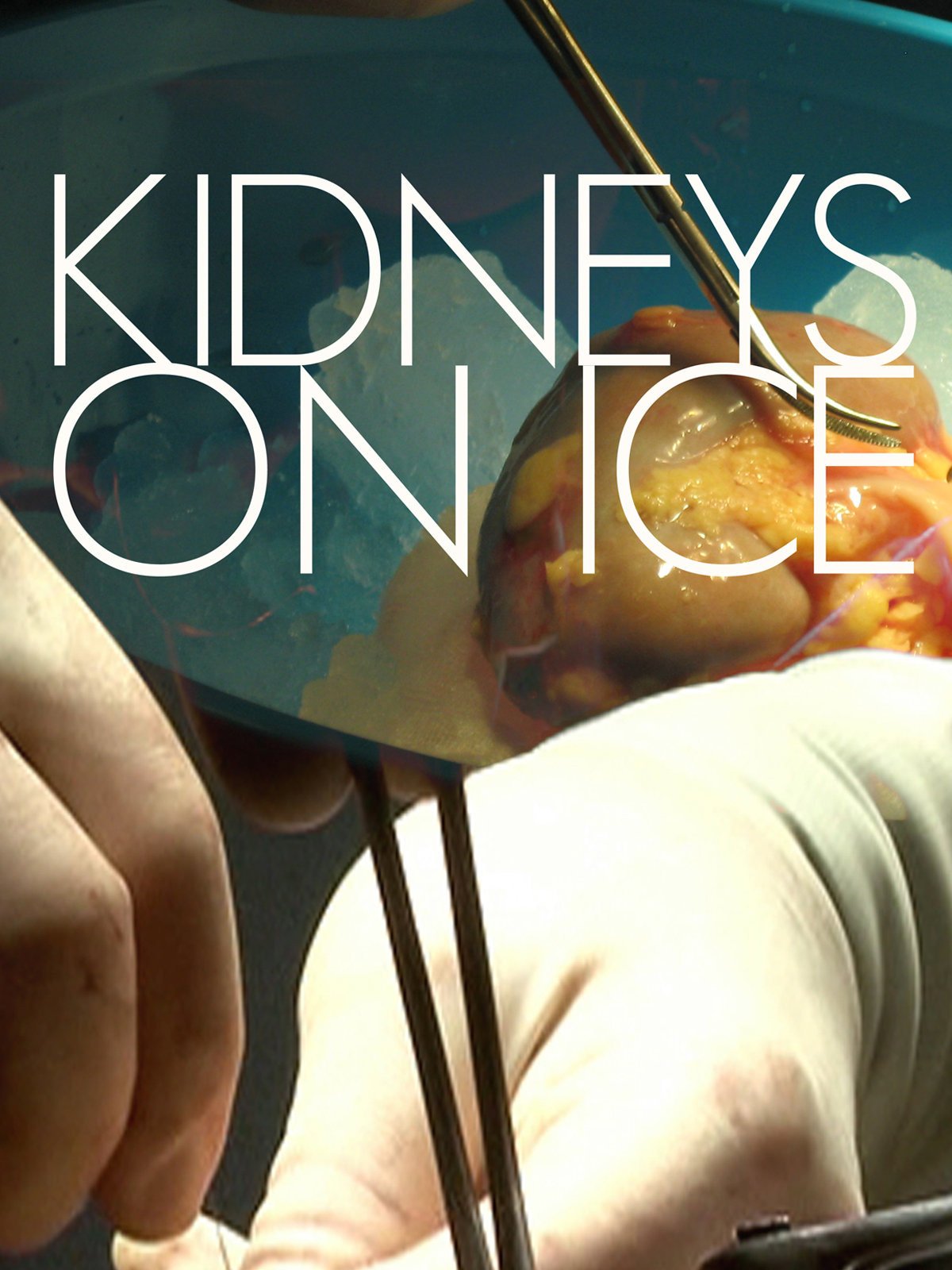 Watch Kidneys On Ice Prime Video