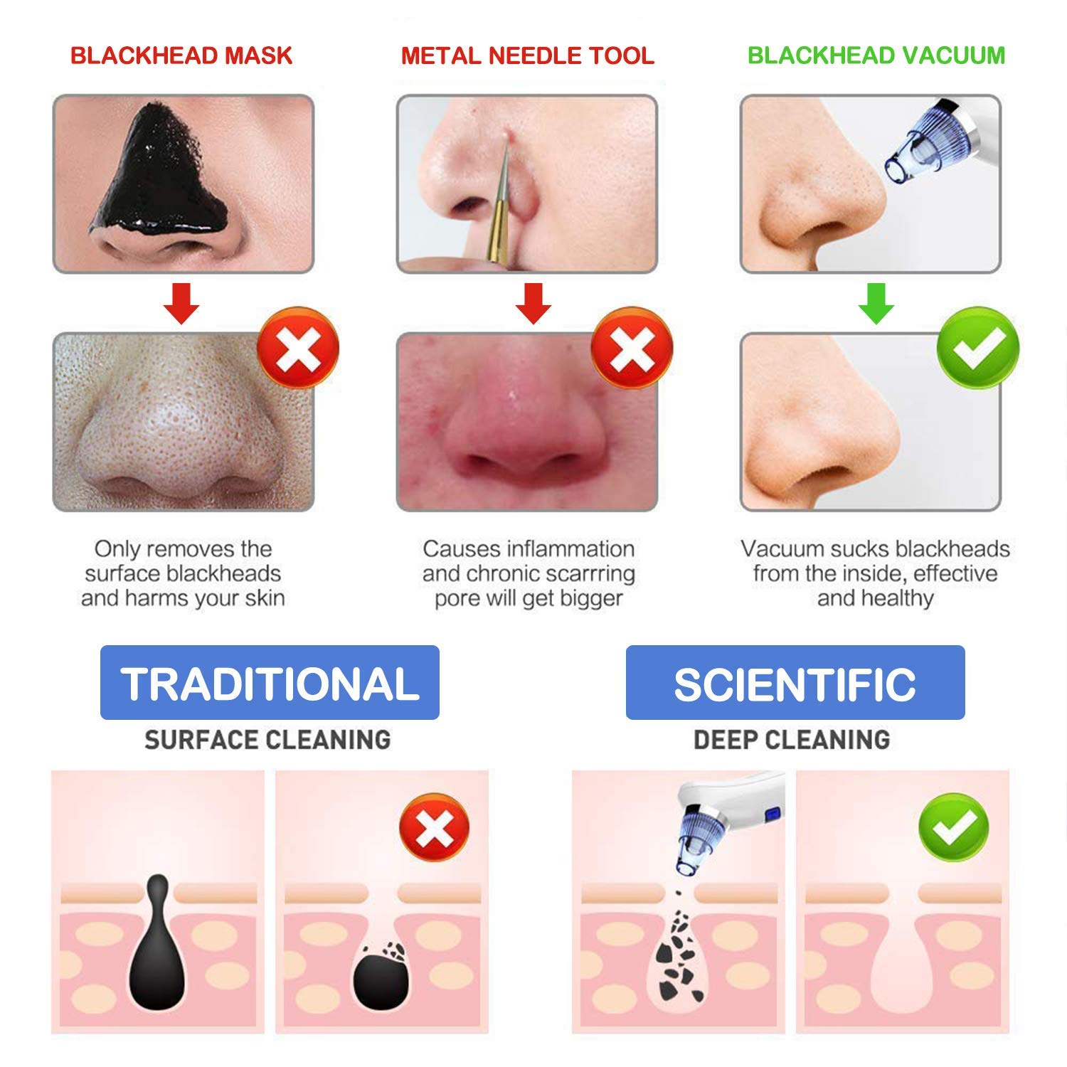 coofo blackhead remover vacuum pore acne cleanser