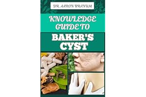 KNOWLEDGE GUIDE TO BAKER’S CYST : Essential Manual To Symptoms, Diagnosis, Treatment Options, And Prevention For Optimal Knee