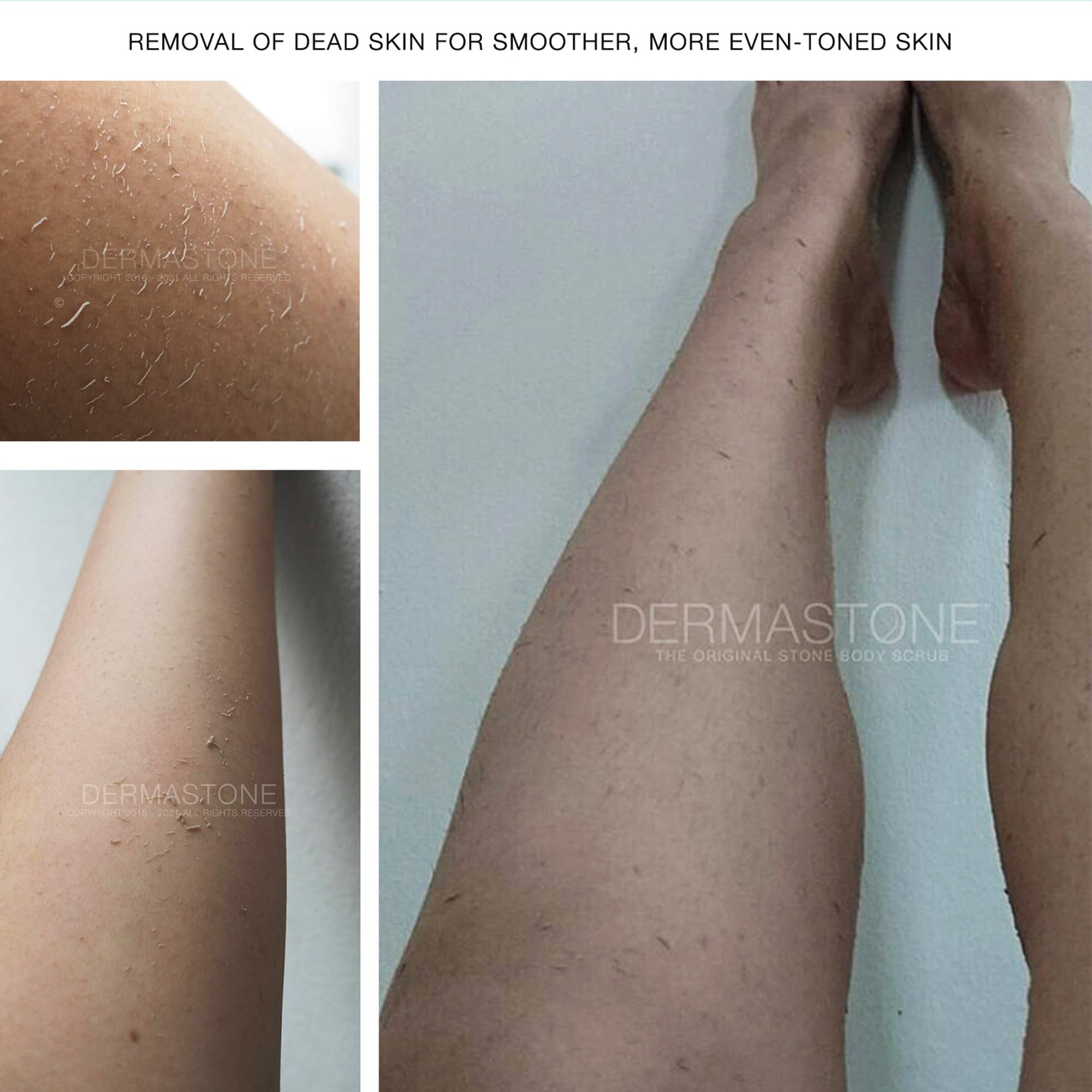 Organic Ingrown Hair Treatment For Women, Strawberry Legs Treatment, Natural Dead Skin Remover, & Foot Scrub Exfoliator For Dry Skin