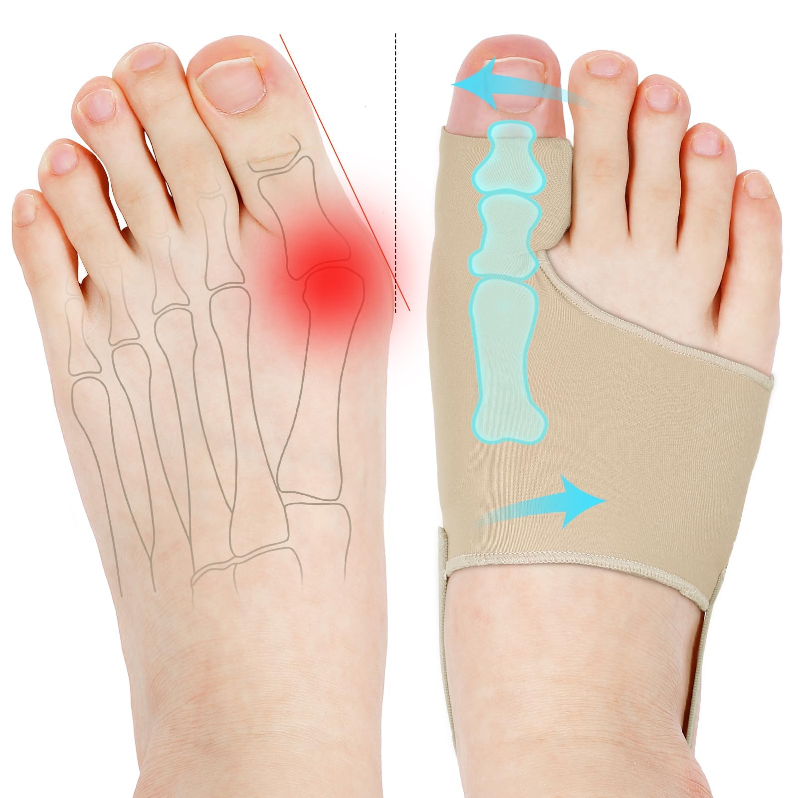 Photo 1 of KTSAY Bunion Corrector for Women, Big Toe Straightener with Splint & Pads, Breathable for Day Support