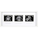 Pearhead Trimester Progression Sonogram Picture Frame, Pregnancy Milestone Keepsake Photo Frame, Sonogram Keepsake, Gender-Ne