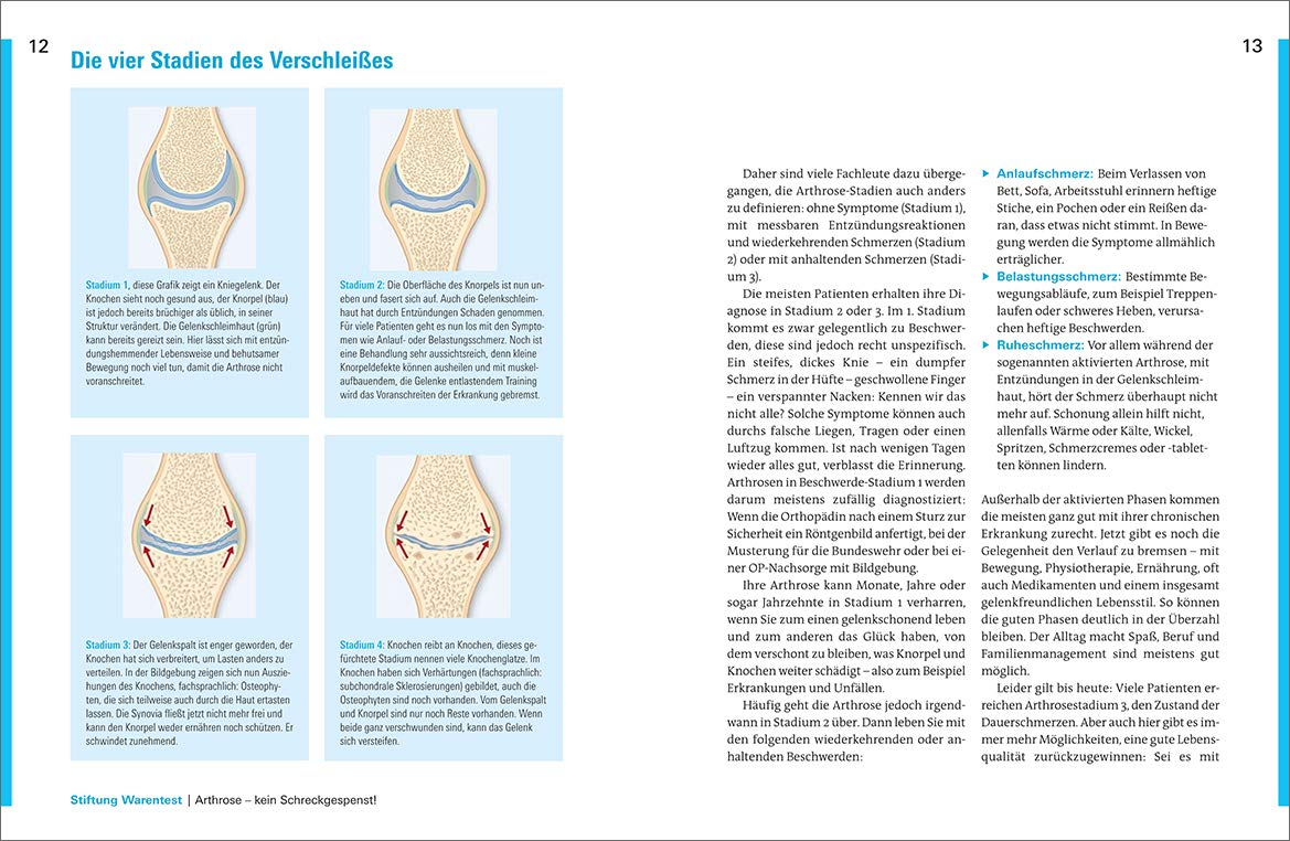 Aktiv Leben Mit Arthrose Das Endlich Schmerzfrei Buch Amazon De Plaum Petra Bucher Aktiv Leben Mit Arthrose Das Endlich Schmerzfrei Buch Amazon De Plaum Petra Bucher