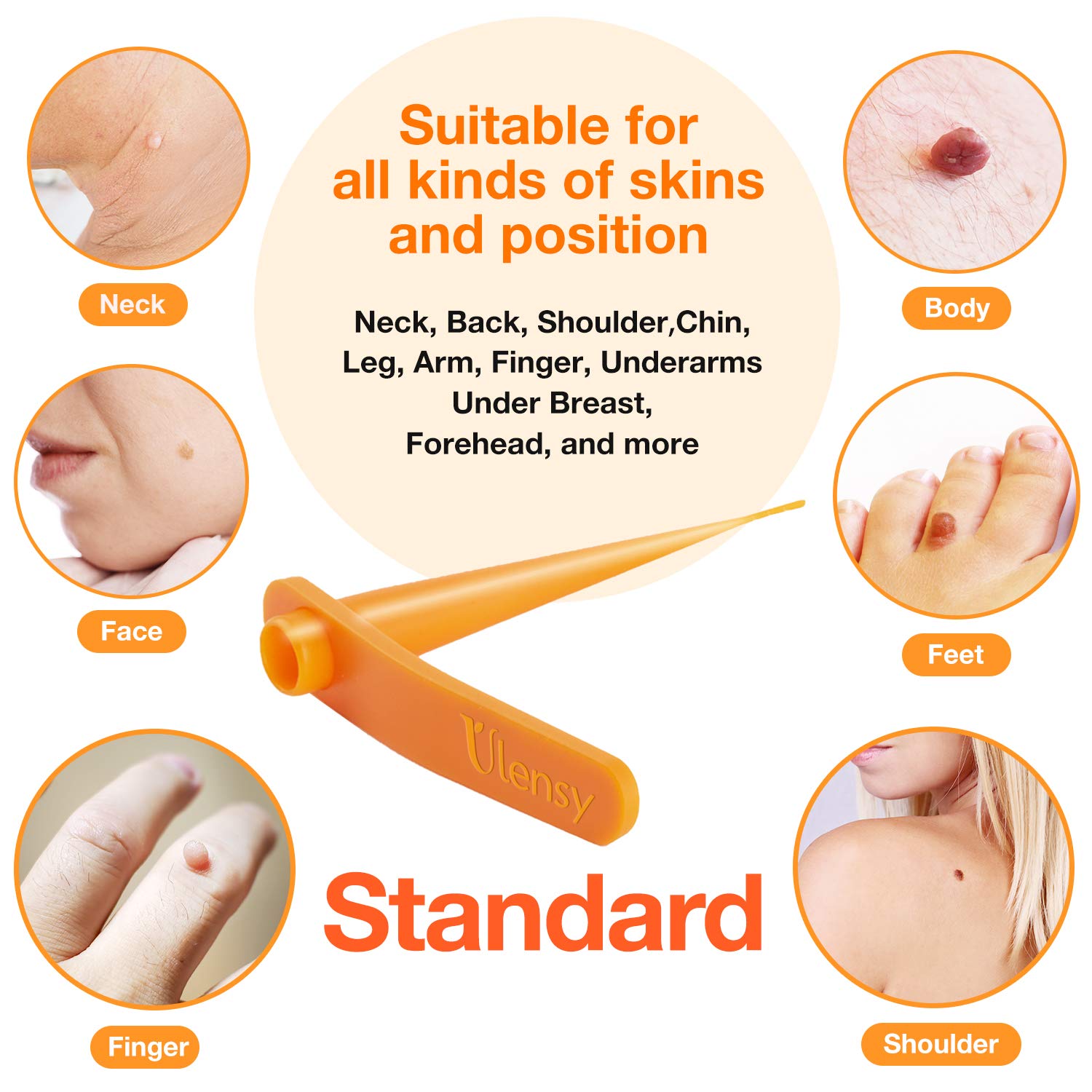 Ulensy Skin Tag Remover, Standard Skin Tag Removal Kit with 36Pcs Repair Patches for Face, Neck, Finger and Body, for Medium to Large (4mm to 8mm) Sized Skin Tags, Safe and Painless, Smooth Results : Beauty