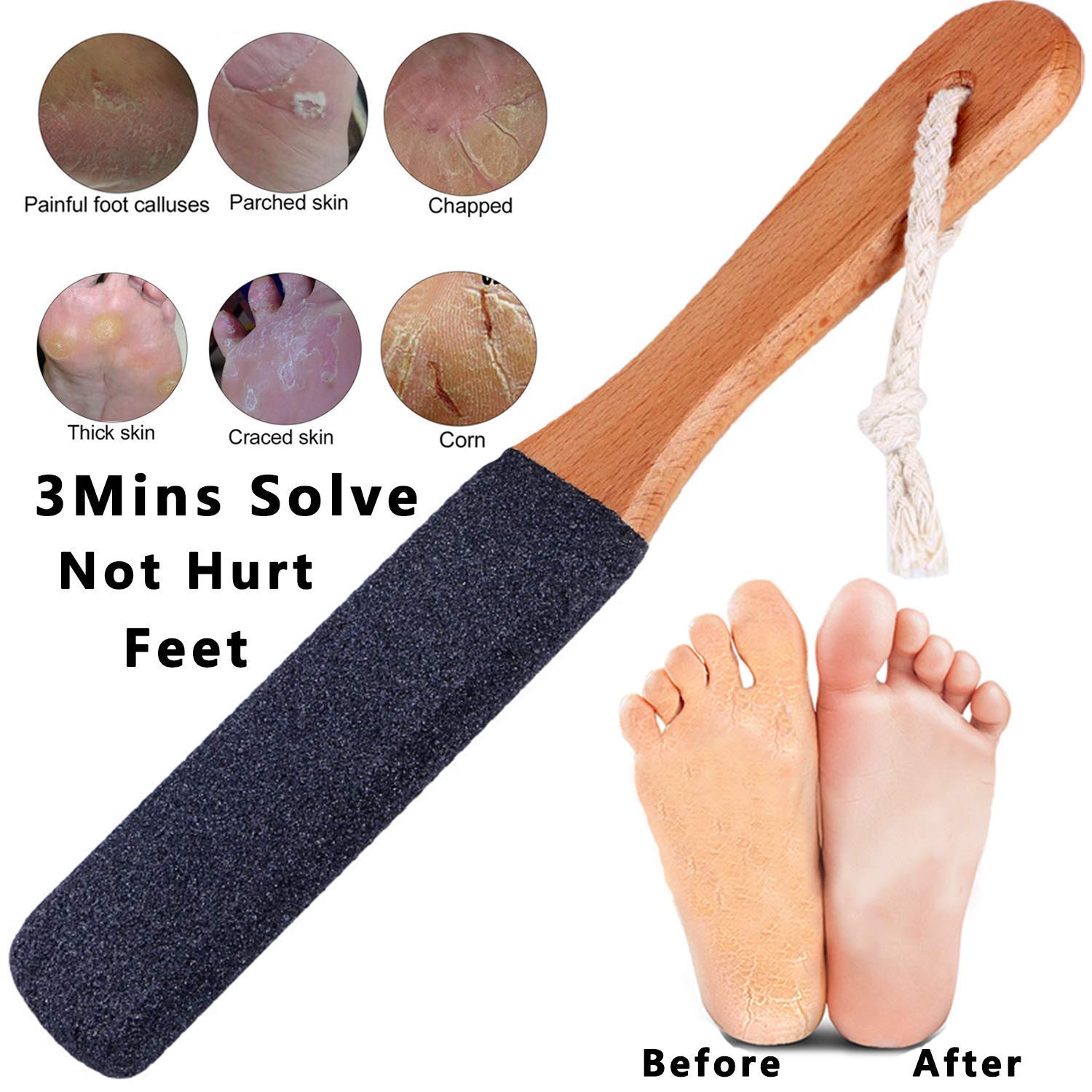 Vridale Pumice Stones for Feet Lava Pumice Stone Foot File Callus Removal Foot Scrubber for Hands Care Foot Exfoliation Dead Skin Remover with Handle: Beauty