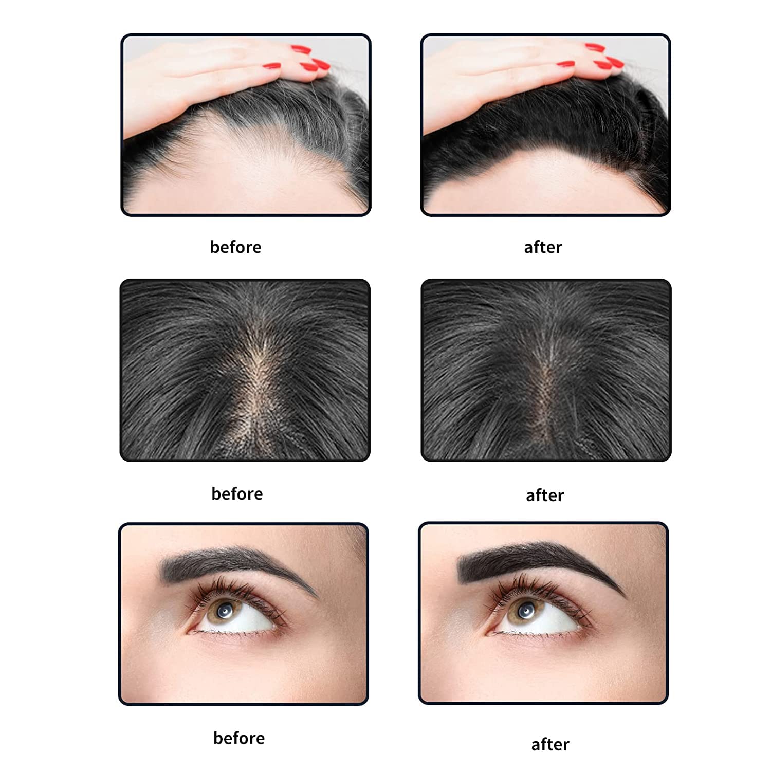 ANMANSY Hairline Powder Magical Instantly Hair Line Shadow Quick Cover Hair Root Concealer with Puff Touch, Root Cover Up for Thinning Hair, Waterproof, Non-sticky (Dark Brown)