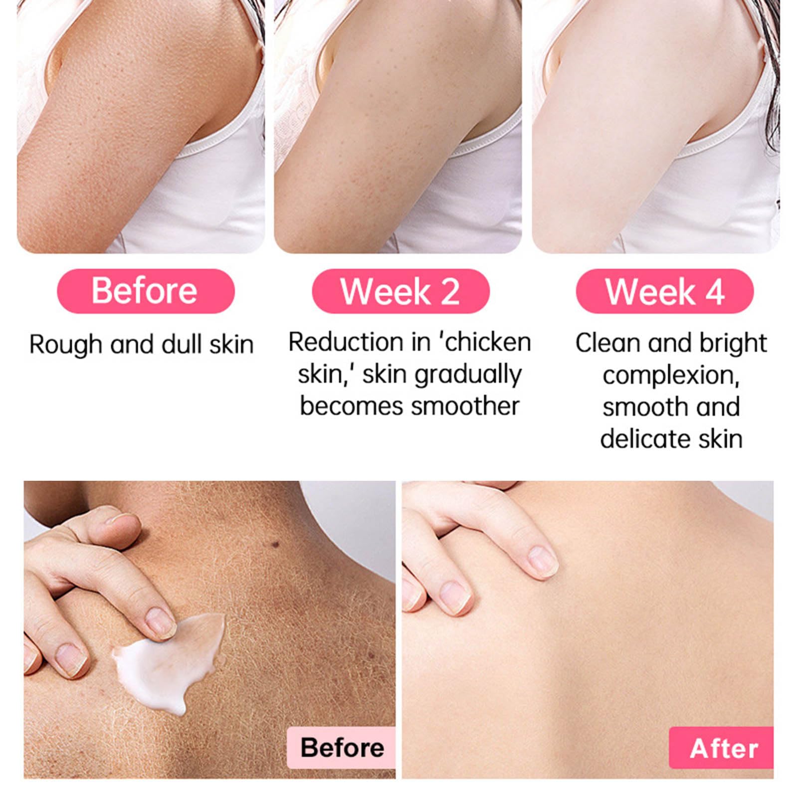 Strawberry Legs Treatment For Women,Bump Eraser Body Scrub, Keratosis Pilaris Treatment,Rough Bumpy Body Cream, Bump Eraser Body Scrub,Smoothing & Buffing Body Scrub Body Care