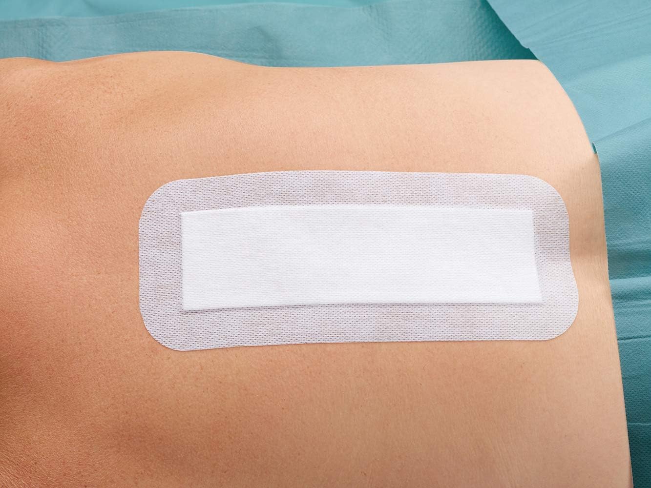 Dukal Island Dressing. Pack of 25 Adhesive Dressings 4" x 14" for Wound Protection. Sterile dressings with Non-Adherent Island pad. Single use: Health & Personal Care