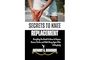 Secrets to Knee Replacement: Everything You Knee’d to Know to Prepare, Recover Faster, and Walk Strong Again After Arthroplas