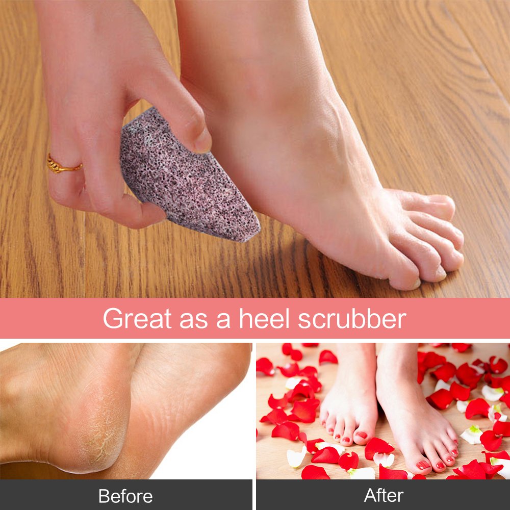 2 Pack Drops Shape Pumice Stone, Horsky Earth Lava SPA Soft Healthy Foot Callus Remover for Dry Hard Dead Skin Cracked Heel in Feet and Hands Skin Exfoliator Scrubber