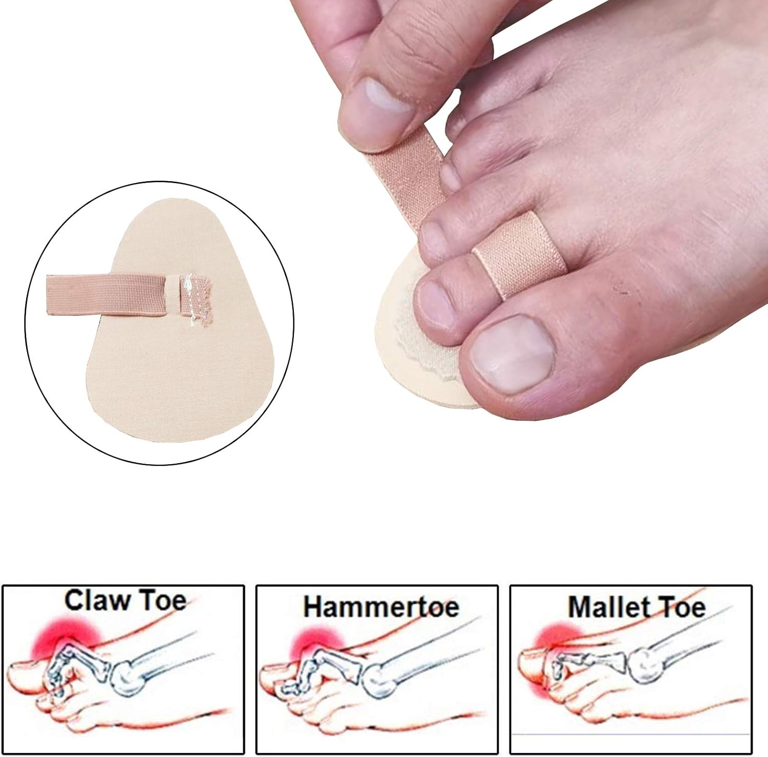 Mcvcoyh Adjustable 2 Loops Toe Splint, Hammer Toe Cushion for Toe Claw Curled & Crooked Toes - Support Guard Protector for PrePost - Image 5