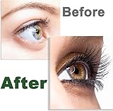 GoldWorld Castor Oil 2 Packs with Free Lash&Brow Brushes & E-Book view 3