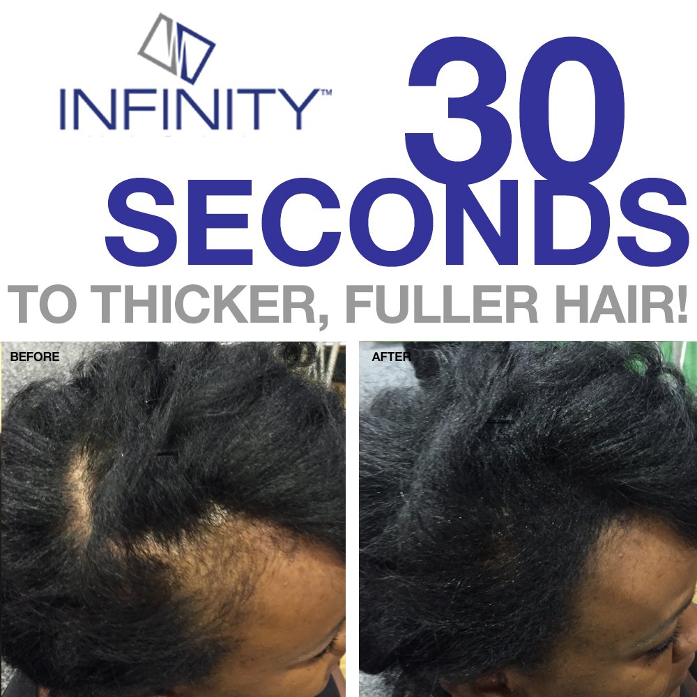 Infinity Hair Fiber Hair Loss Concealer Hair Thickening Fiber for