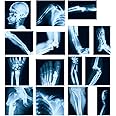 Sayglossy 15 Pcs Broken Bones x Ray Set Human x Rays Black and Blue Skeleton Pretend Xrays for Kids