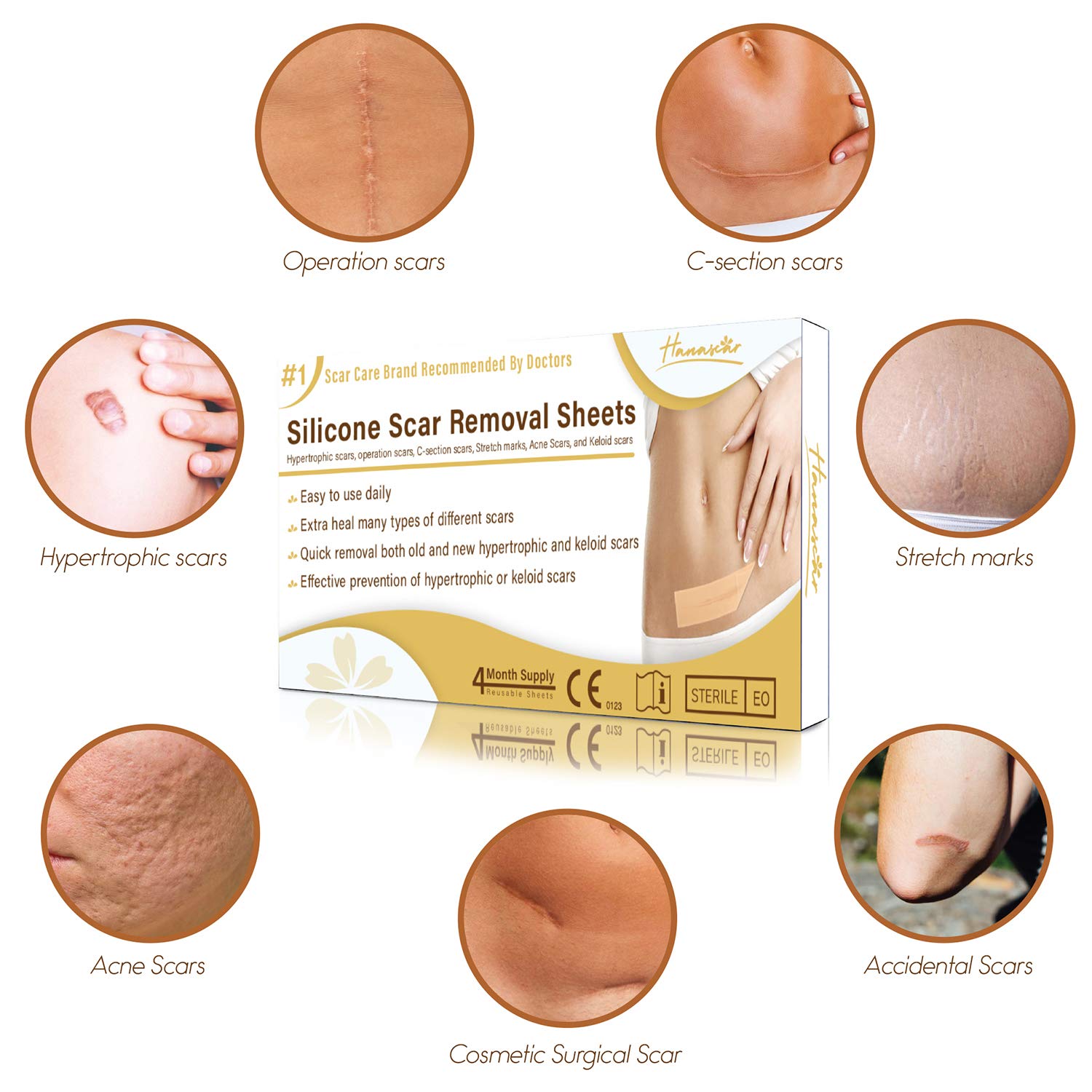 HANASCAR Professional Silicone Scar Removal Sheets, Treat Scars Caused by C-Section, Surgery, Burn, Injuries, Acne, and Stretch Marks, Works on Old & New Scars, 5.7"×1.57”, 4 Reusable Sheets : Beauty