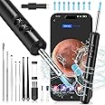 Ear Wax Removal, Upgraded Ear Cleaner with 1920P Camera, Ear Wax Removal Tool Camera with 8 Pcs Ear Set, Ear Wax Removal Kit with 7 Ear Spoon, Ear Cleaner with Lights, Ear Camera for iOS & Android