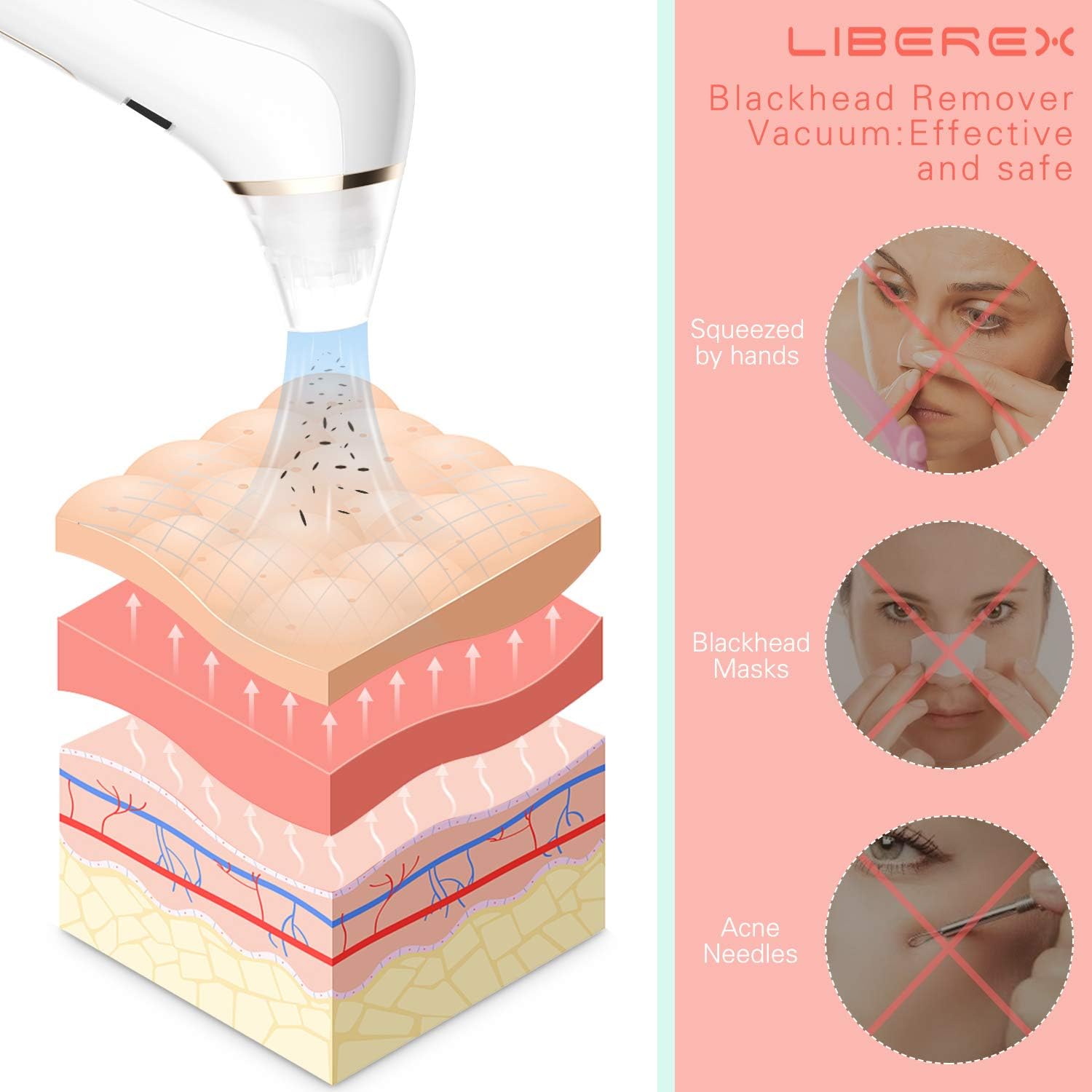 Liberex Blackhead Remover Pore Vacuum - Blue & Red Light Therapy Pore Cleanser, Diamond Microcrystalline Electric Acne Extractor, 4 Suction Heads with 5 Intensity Levels, USB Rechargeable (Rose Gold): Health & Personal Care