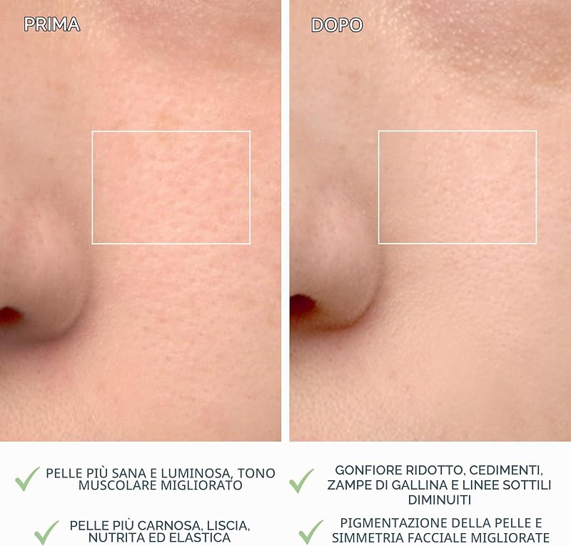 LUNA 4, spazzola detergente viso - Massaggio viso rassodante - Spazzola viso anti-age - Favorisce l'assorbimento delle formule di skincare - Pulizia viso semplice - Combination Skin
