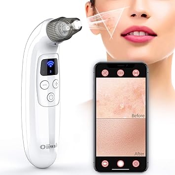 Blackhead Remover with Camera 
